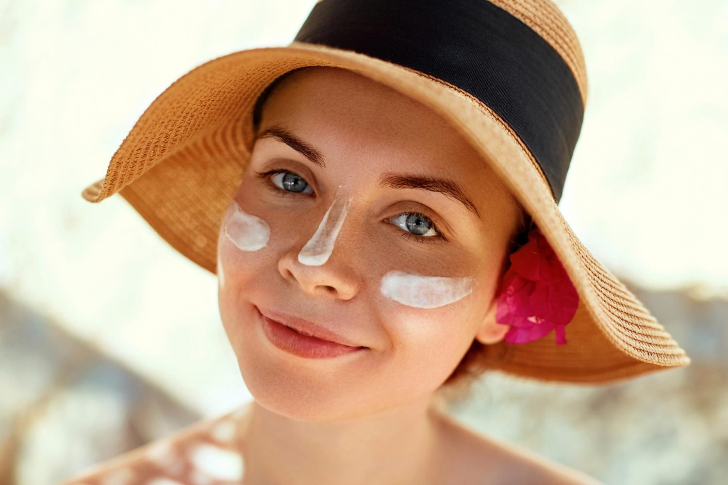 Dra. Aline Baptista - Cuidar da pele com melasma no verão